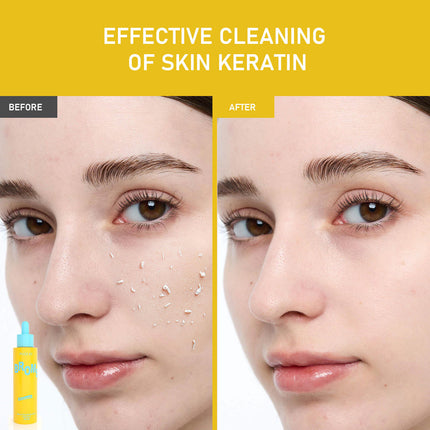 Papaya Enzyme Peeling Solution | AHA + BHA Gentle Exfoliator – Blash Boom Beauty